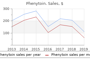 buy phenytoin on line amex