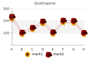 order quetiapine with amex