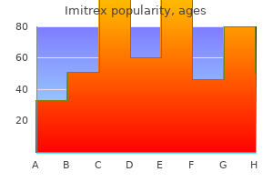 order 25 mg imitrex