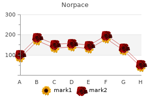 norpace 150 mg cheap
