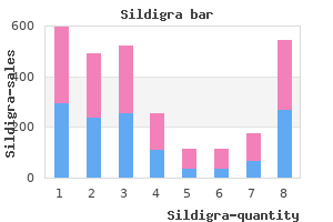 50 mg sildigra