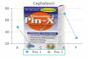 purchase 500 mg cephalexin with mastercard