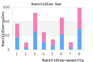buy ranitidine 150mg visa