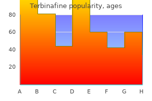 buy terbinafine 250mg mastercard
