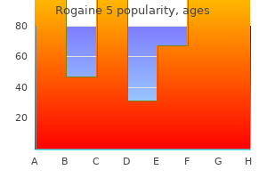 purchase rogaine 5 60ml without prescription