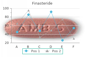 purchase generic finasteride