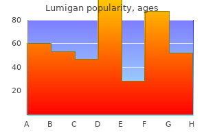 discount lumigan 3ml fast delivery